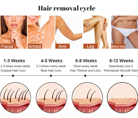 Salon piękności IPL Maszyna laserowa usunięcie włosów RF pielęgnacja skóry usunięcie tatuażu