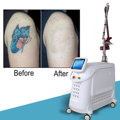1064nm Q Switched Nd Yag Laser Picosecond Maszyna do usuwania tatuaży
