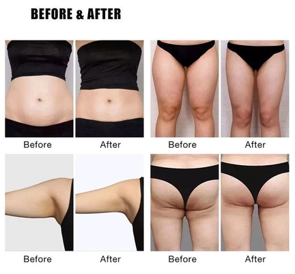 Maszyna do odchudzania EMS Slim 4000W Elektromagnetyczna Maszyna do odchudzania EMS Sculpting Machine
