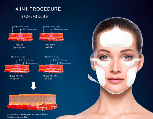 Vertical Magnetic Facial Ems rf Odmłodzenie skóry Podnoszenie skóry Przyciskanie skóry Schudnięcie Rf Podnoszenie maszyny machifor sal