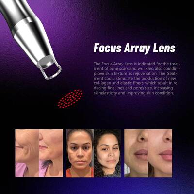 3000W 350PS Picosecond Pico Way Laser Pigment Removal Nd Yag Laser Picosecond Tatoo Removal Laser Machine EU Plug
